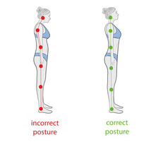 Postural Correction