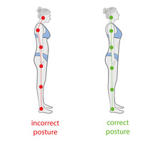 Postural Correction